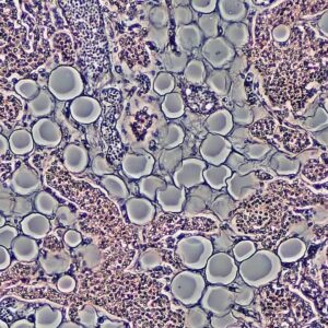 laboratuvarda ilk canli insan derisi gelistirildi LCkTyhsJ