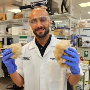 sac proteinleri disleri onariyor yHS2abue