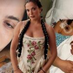 Asli bekiroglu 8 kez ameliyat oluyor son insallah 3JKfyKWk
